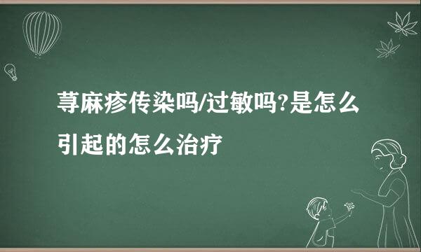 荨麻疹传染吗/过敏吗?是怎么引起的怎么治疗